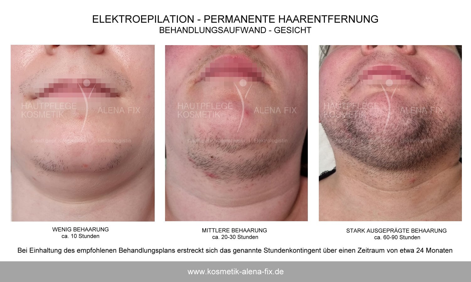 Elektroepilation Gesicht Erfahrungen